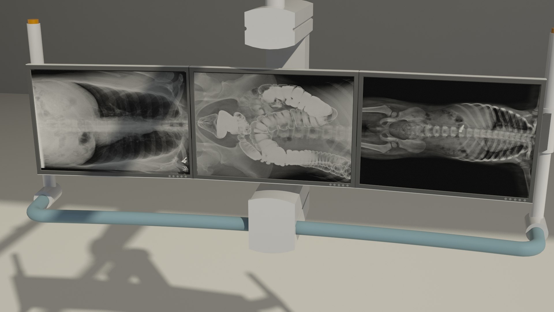 3d model revit medical equipment siemens https://p.turbosquid.com/ts-thumb/Yx/JJVmo5/8Unh4cxi/carmimage8/jpg/1380300239/1920x1080/fit_q87/b751ee99a0816ea665d51d658e5c2b2afcaa2ad1/carmimage8.jpg