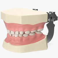 Pediatric Typodont Demonstration Model with Removable Gapped Teeth