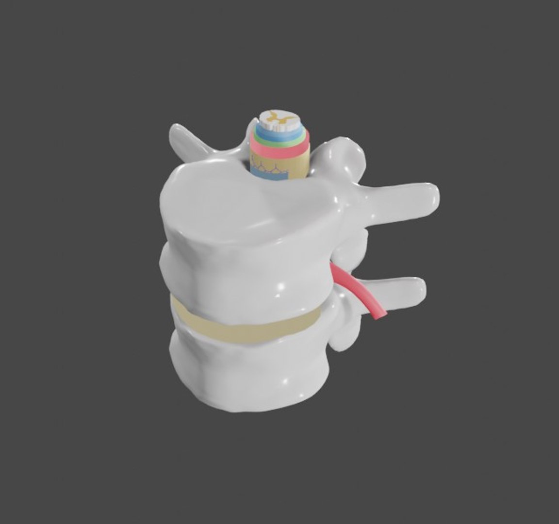 3D Slipped Disc - TurboSquid 1570000