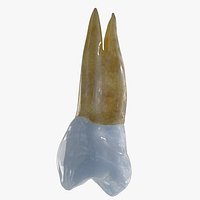 Upper First Left Bicuspid