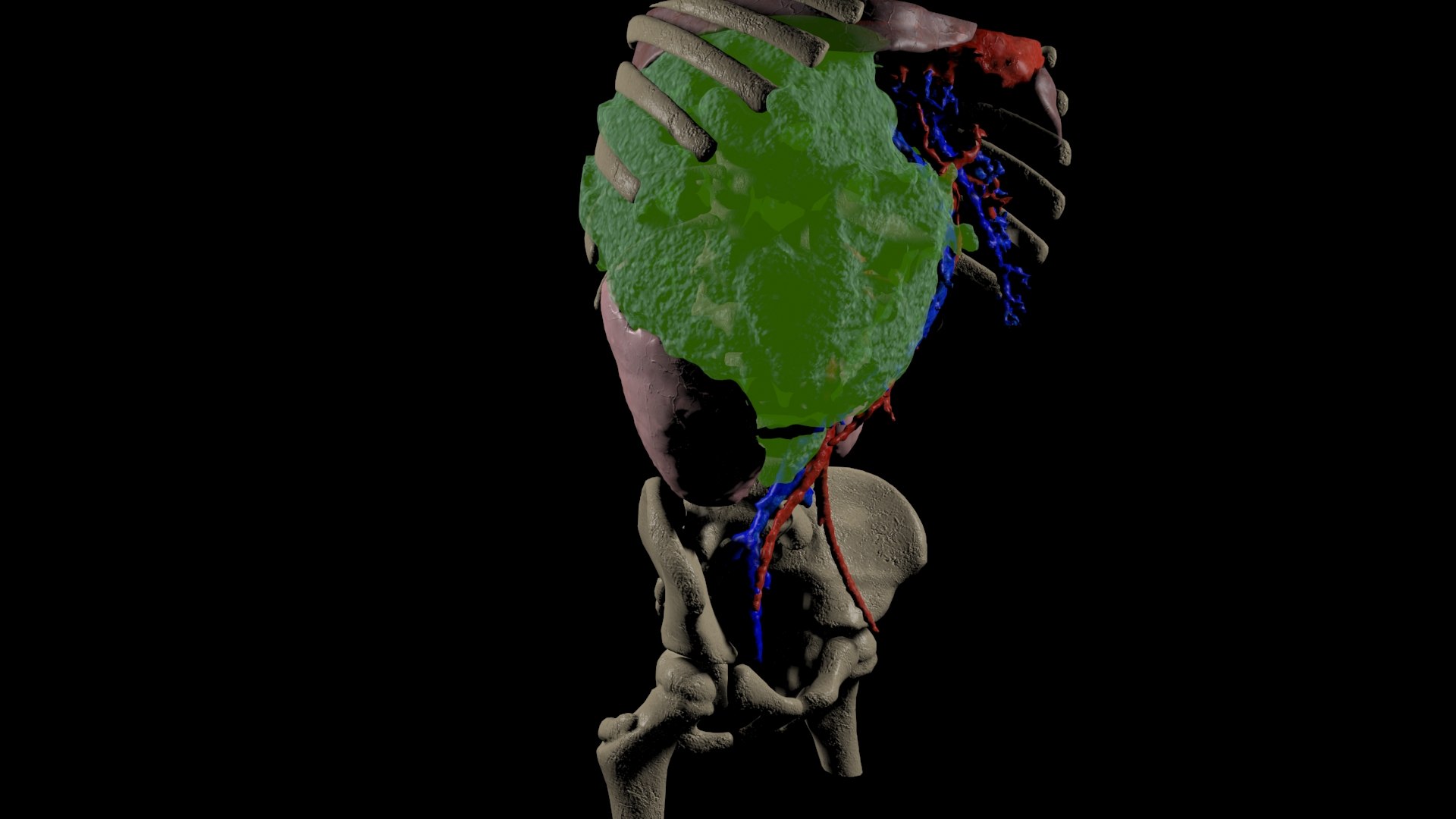 3D tumor kidney model https://p.turbosquid.com/ts-thumb/ZU/pYdbFQ/fk/tk3/jpg/1608380891/1920x1080/fit_q87/a0b582da91f599d4b28e083c057ffa91e1a319e8/tk3.jpg