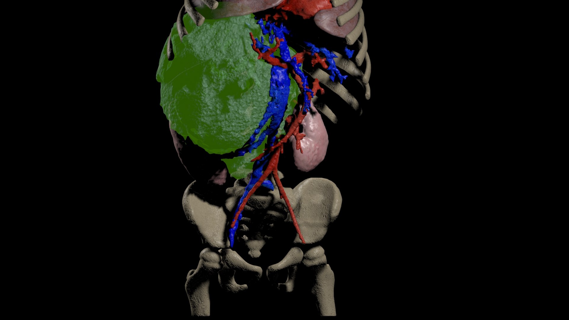 3D tumor kidney model https://p.turbosquid.com/ts-thumb/ZU/pYdbFQ/rg/tk4/jpg/1608380892/1920x1080/fit_q87/d6a387f9fd5fec6df5b663cdae56e07e3560df56/tk4.jpg