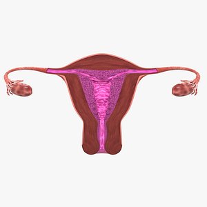 Uterus endometrial lesions model set - hyperplasia polyp cyst cancer model set 3D