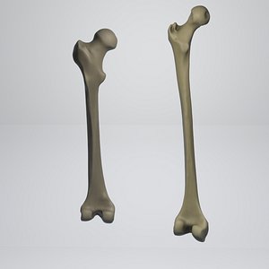 Tibia bone