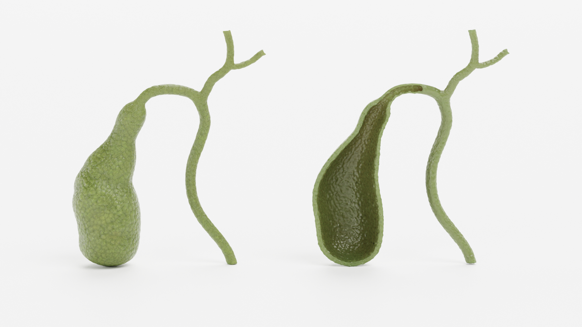 3D Gallbladder and Gallbladder Section model https://p.turbosquid.com/ts-thumb/Zy/rDvTjf/vL/0001/png/1625648322/1920x1080/turn_fit_q99/ee02376be9b7460a5a66e5f0d7932875ea3510d1/0001-1.jpg