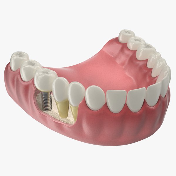 lower teeth medical dental 3D model