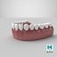 lower teeth medical dental 3D model