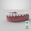 lower teeth medical dental 3D model