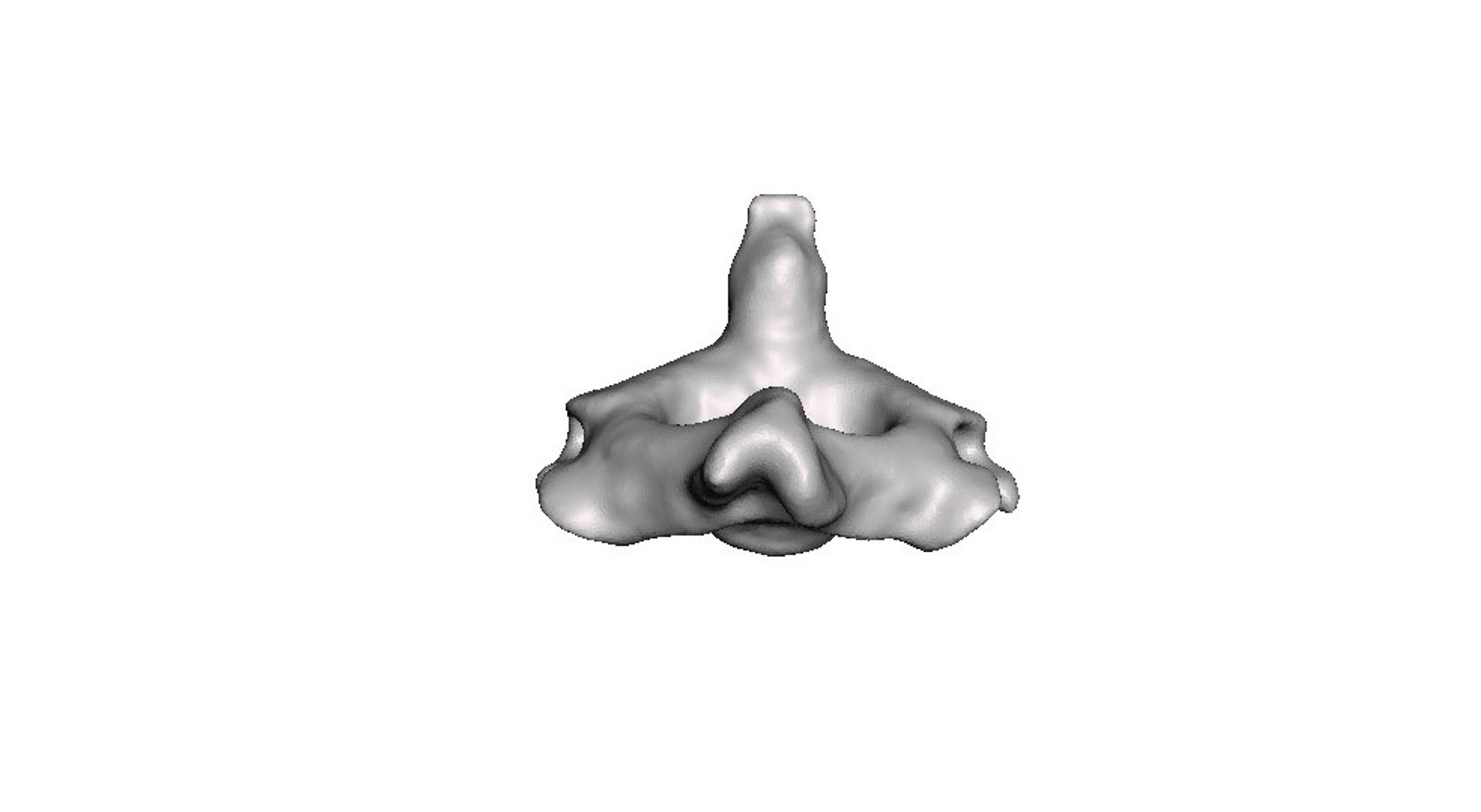 3D surgeries neck anatomy https://p.turbosquid.com/ts-thumb/a6/mKcCrt/M0DMT5nq/6/jpg/1599504854/1920x1080/fit_q87/608e579302cd4b0eb823edb092c7f17fa866367b/6.jpg