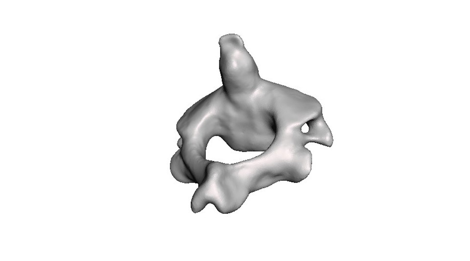 3D surgeries neck anatomy https://p.turbosquid.com/ts-thumb/a6/mKcCrt/iQpMP6jB/5/jpg/1599504844/1920x1080/fit_q87/e6c0df7a816297e00eb47e7b3195cbe49918b3ab/5.jpg
