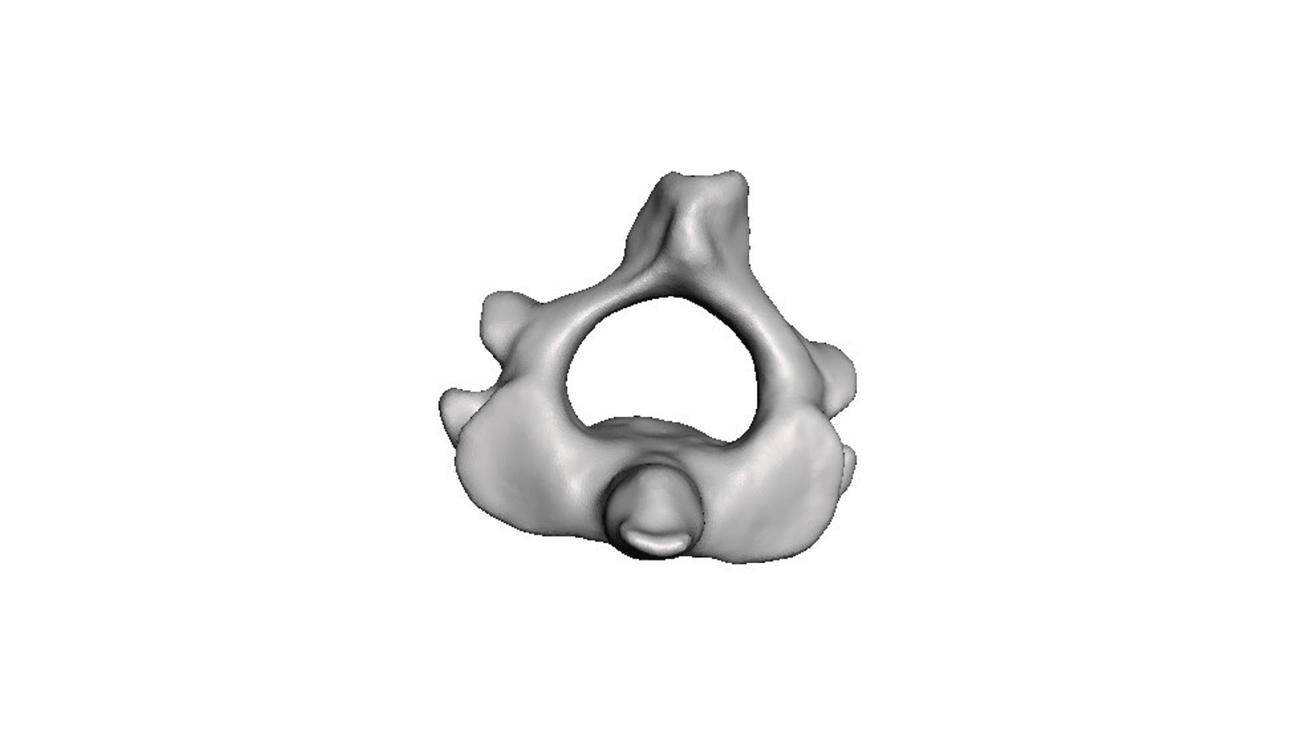 3D surgeries neck anatomy https://p.turbosquid.com/ts-thumb/a6/mKcCrt/mxEg9Feb/8/jpg/1599504889/1920x1080/fit_q87/041e6c5ba9f9b6710583370d83ae0510db8b1b7a/8.jpg