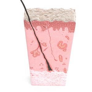 Skin Cross Section