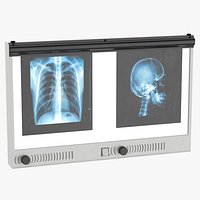 Xray Film Viewer