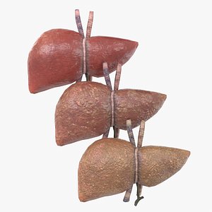 Human Liver