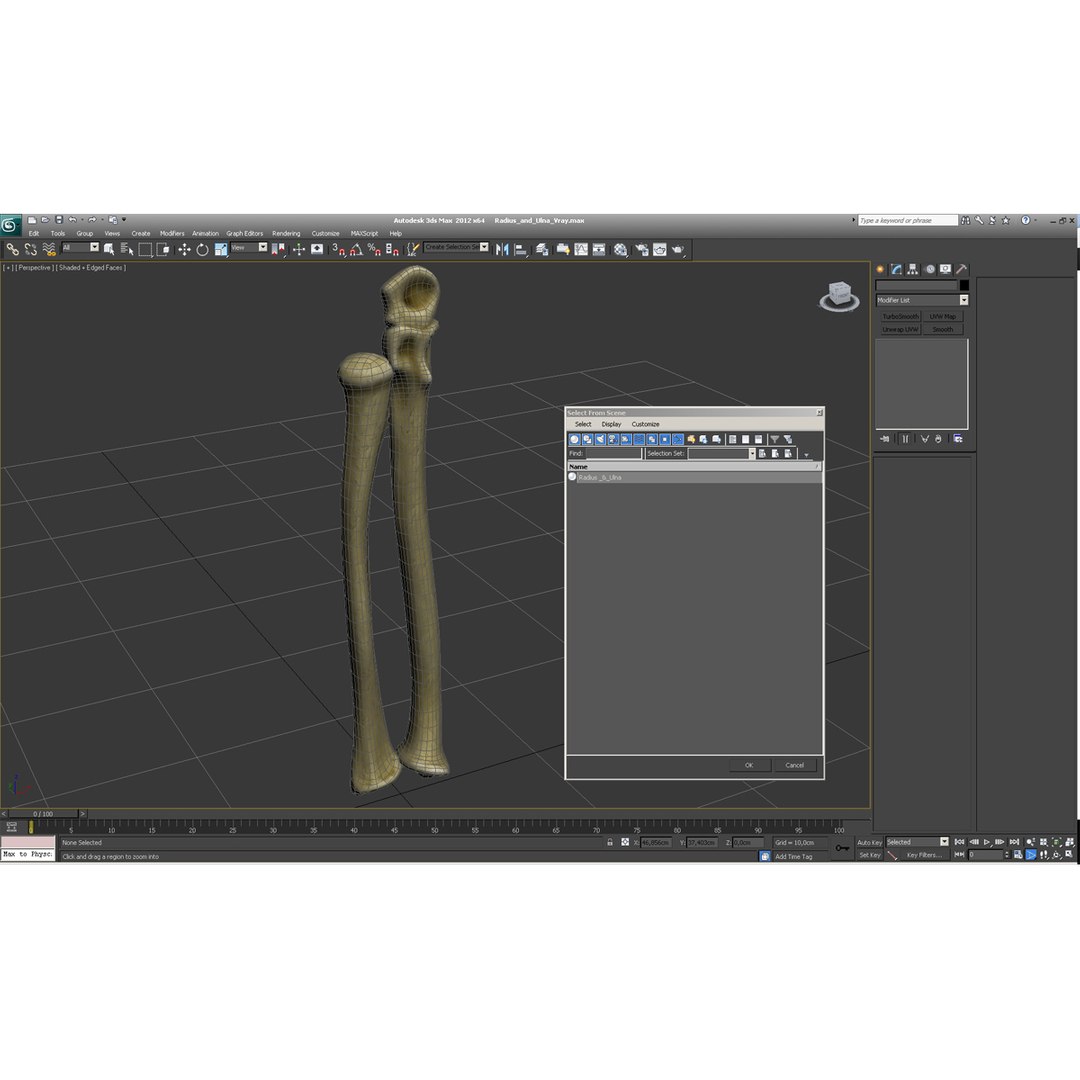 3d Model Radius Ulna