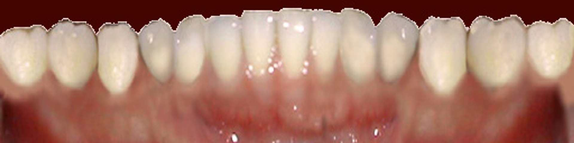 shavana warrior max https://p.turbosquid.com/ts-thumb/aD/terTpm/6m5kXIHD/sh_teethlower/jpg/1434331488/1920x1080/fit_q87/108c465643c9299dac0da5255d37b67783b227ae/sh_teethlower.jpg