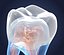 Transparent tooth and crown. 3d model of endodontics inner structure