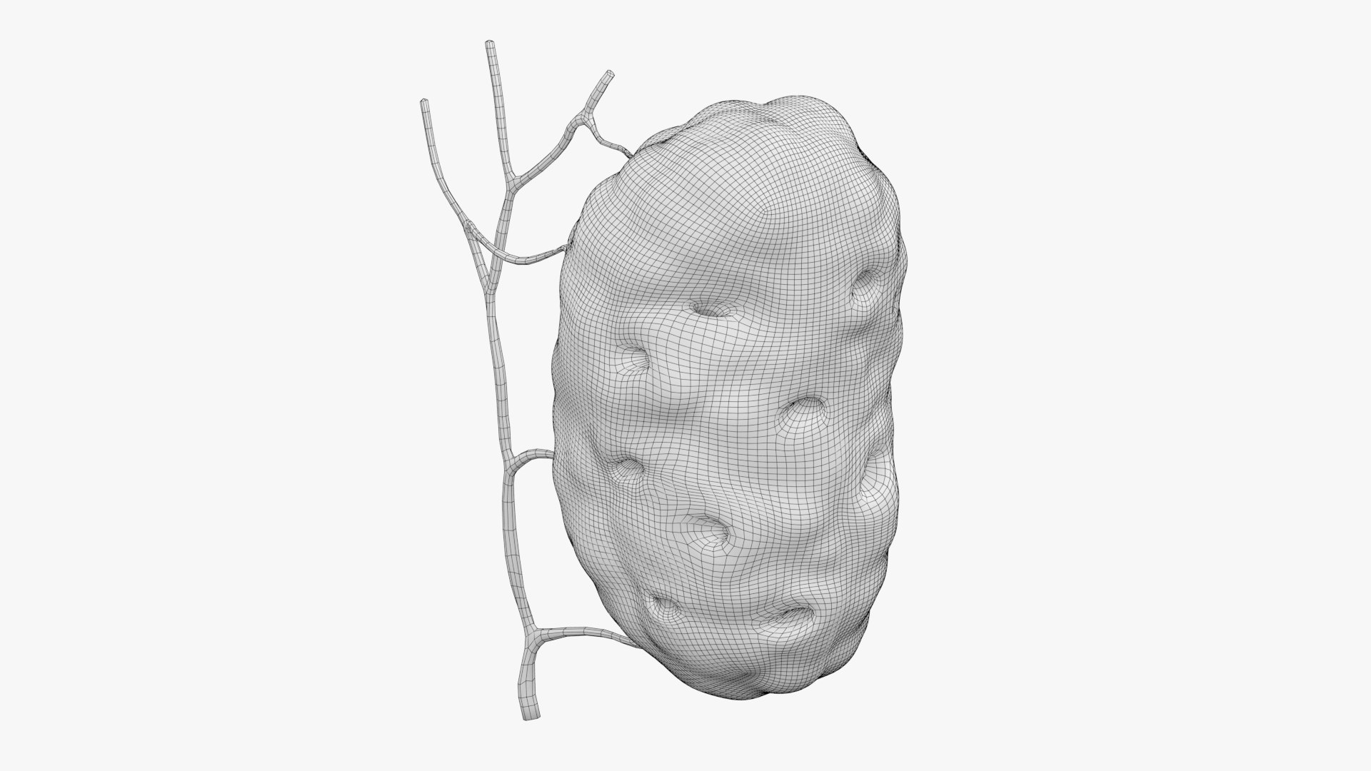 3D Palatine Tonsil - TurboSquid 1933972