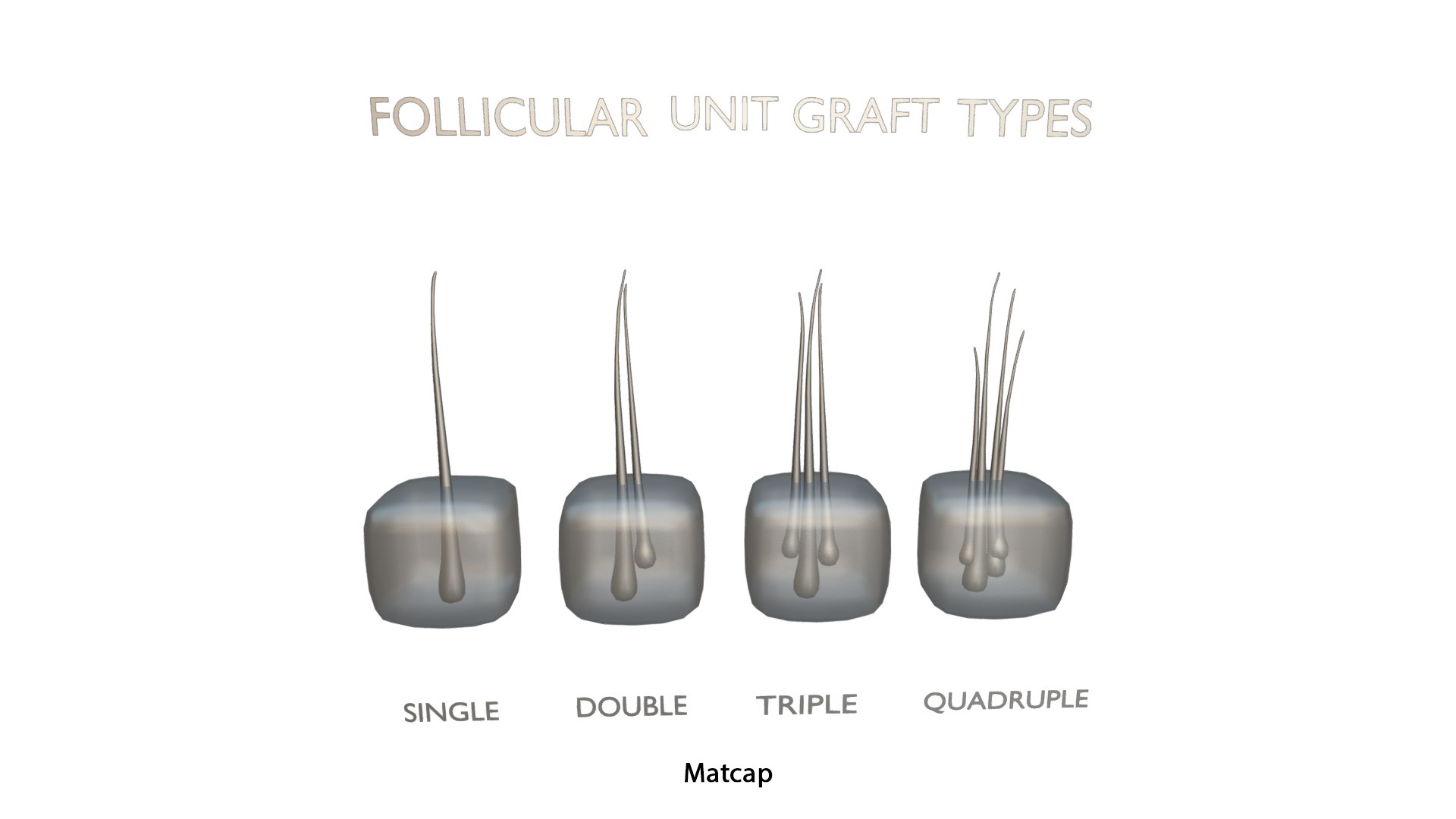 3D Follicular Unit Graft Types model https://p.turbosquid.com/ts-thumb/af/6uCXiA/LF/follicular_unit_graft_types_matcap_1/png/1766048202/1920x1080/fit_q87/37c14b2009d5a79fece5d4c608613f3fe10ed707/follicular_unit_graft_types_matcap_1.jpg
