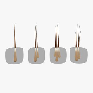 3D Follicular Unit Graft Types model