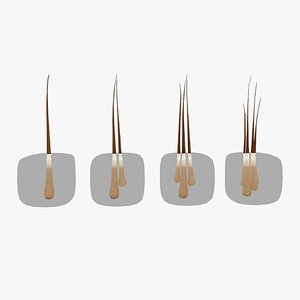 Follicular Unit Graft Types