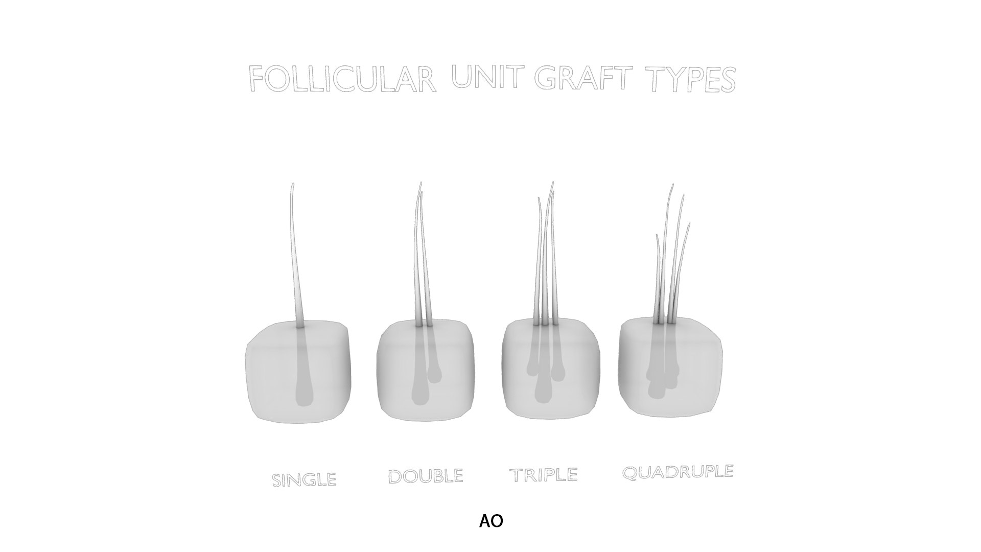 3D Follicular Unit Graft Types model https://p.turbosquid.com/ts-thumb/af/6uCXiA/wT/follicular_unit_graft_types_ao/png/1766048200/1920x1080/fit_q87/a5713d8b08ee9e28036f79d387e54f1b3bdfb338/follicular_unit_graft_types_ao.jpg