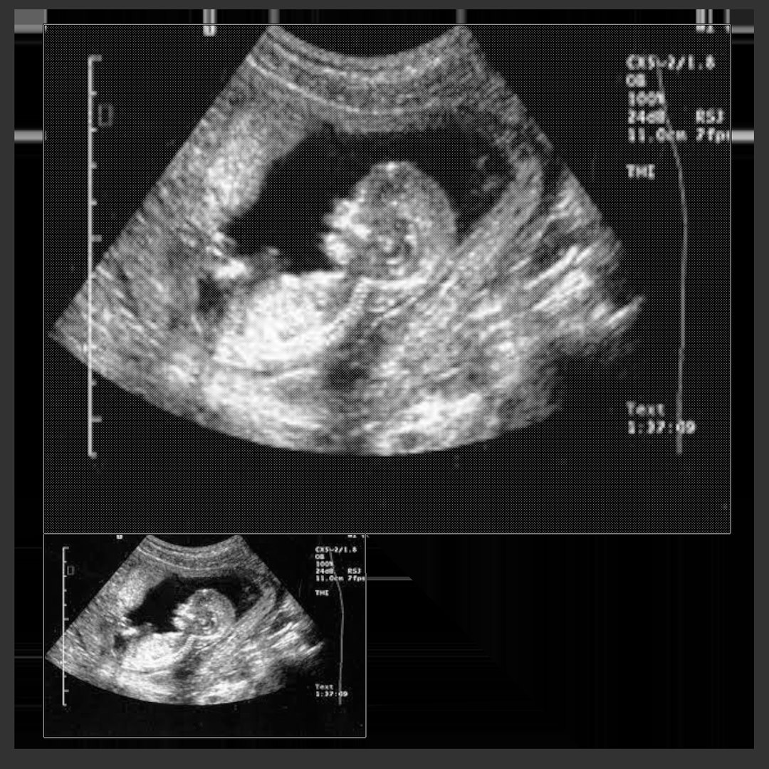 11 недель и 3 дня. УЗИ при беременности 13 недель. 13 Недель беременности фото плода на УЗИ. Эмбрион на 13 неделе беременности УЗИ. УЗИ ребенка на 19 неделе беременности.