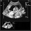 Ultrasonograf SIUI Apogee 3800 PBR