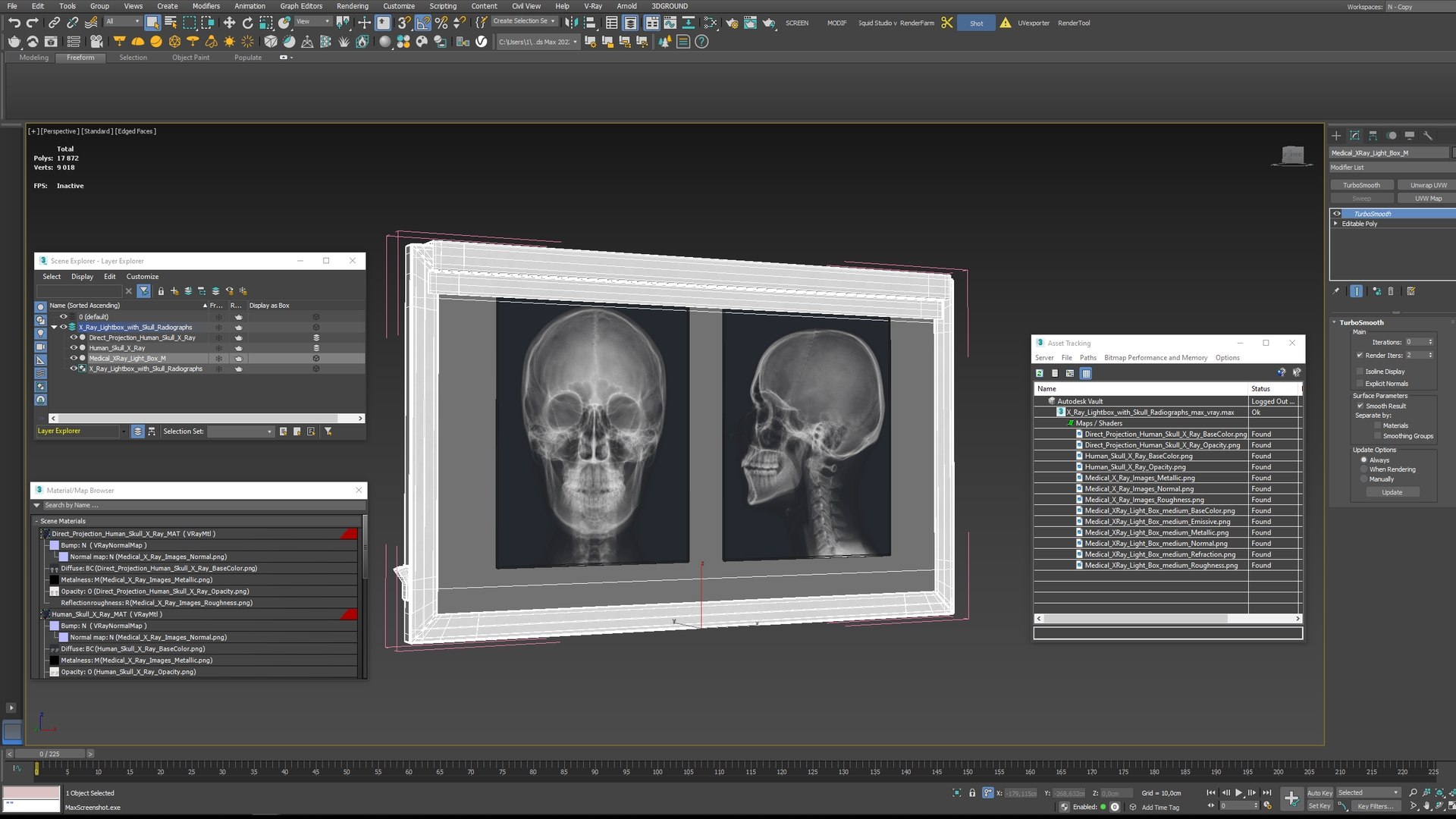 3D X Ray Lightbox with Skull Radiographs model https://p.turbosquid.com/ts-thumb/an/GCQoEV/2i/x_ray_lightbox_with_skull_radiographs_016/jpg/1786491274/1920x1080/fit_q87/ebd8570165d8aa0769721a0ecf979f0cef942003/x_ray_lightbox_with_skull_radiographs_016.jpg