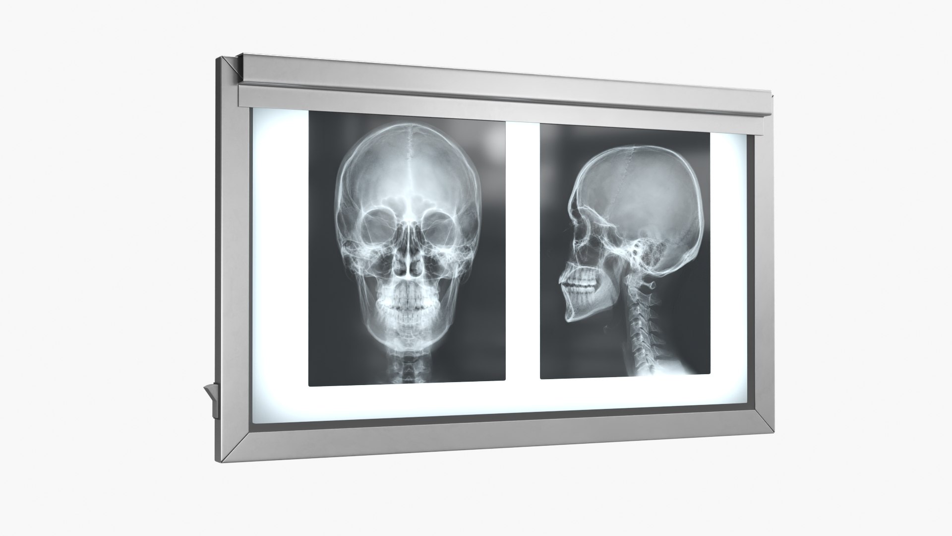 3D X Ray Lightbox with Skull Radiographs model https://p.turbosquid.com/ts-thumb/an/GCQoEV/3S/x_ray_lightbox_with_skull_radiographs_002/jpg/1786491177/1920x1080/fit_q87/092da4a3bf711f5b0d6147012358549ba16431fc/x_ray_lightbox_with_skull_radiographs_002.jpg