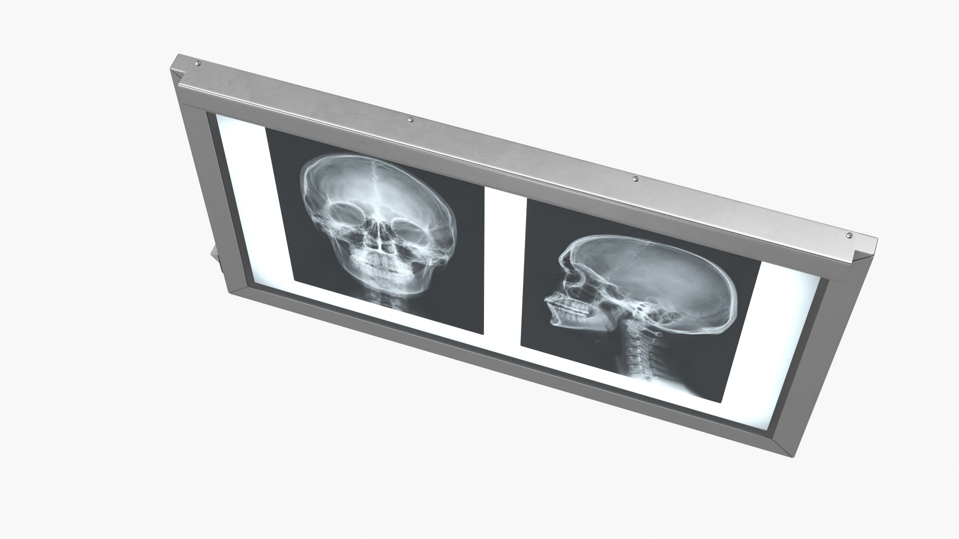 3D X Ray Lightbox with Skull Radiographs model https://p.turbosquid.com/ts-thumb/an/GCQoEV/6Y/x_ray_lightbox_with_skull_radiographs_004/jpg/1786491244/1920x1080/fit_q87/96c4b629970f8005e6c065c78b5274bc6c4f501a/x_ray_lightbox_with_skull_radiographs_004.jpg