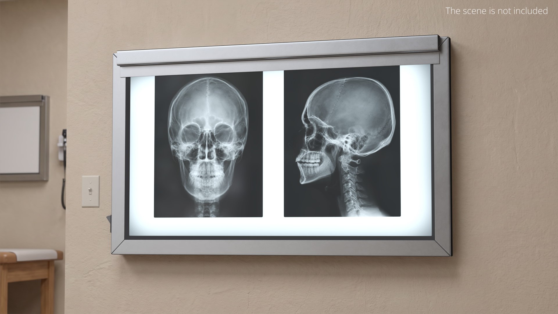 3D X Ray Lightbox with Skull Radiographs model https://p.turbosquid.com/ts-thumb/an/GCQoEV/K1/x_ray_lightbox_with_skull_radiographs_003/jpg/1786491241/1920x1080/fit_q87/3017153125d236cf0d68d7061ace390b97929a5e/x_ray_lightbox_with_skull_radiographs_003.jpg