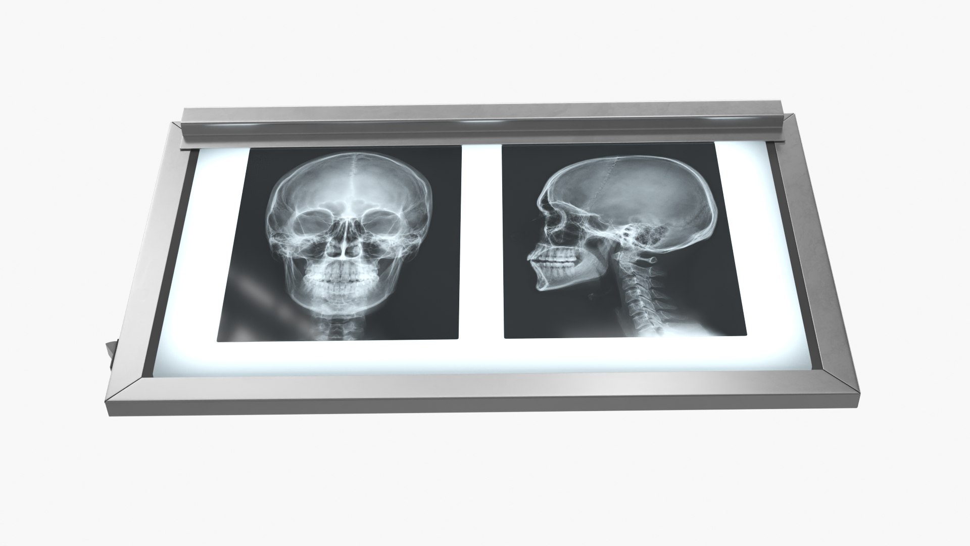 3D X Ray Lightbox with Skull Radiographs model https://p.turbosquid.com/ts-thumb/an/GCQoEV/RJ/x_ray_lightbox_with_skull_radiographs_006/jpg/1786491250/1920x1080/fit_q87/299edc9bff0aa9668c6f1fe993a32dceb9afb24e/x_ray_lightbox_with_skull_radiographs_006.jpg