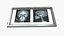 X Ray Lightbox with Skull Radiographs