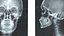 X Ray Lightbox with Skull Radiographs