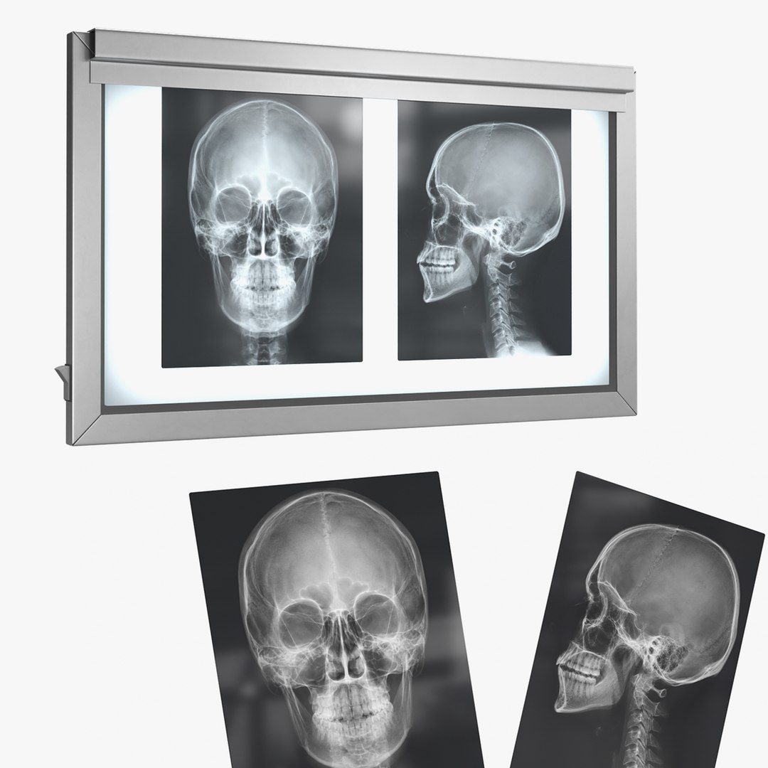 3D X Ray Lightbox with Skull Radiographs model https://p.turbosquid.com/ts-thumb/an/GCQoEV/YU/x_ray_lightbox_with_skull_radiographs_001/jpg/1786491174/1920x1080/fit_q87/ee2d1d78d3ba6bc547db970dea0f764b6873ee55/x_ray_lightbox_with_skull_radiographs_001.jpg