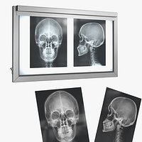 X Ray Lightbox with Skull Radiographs