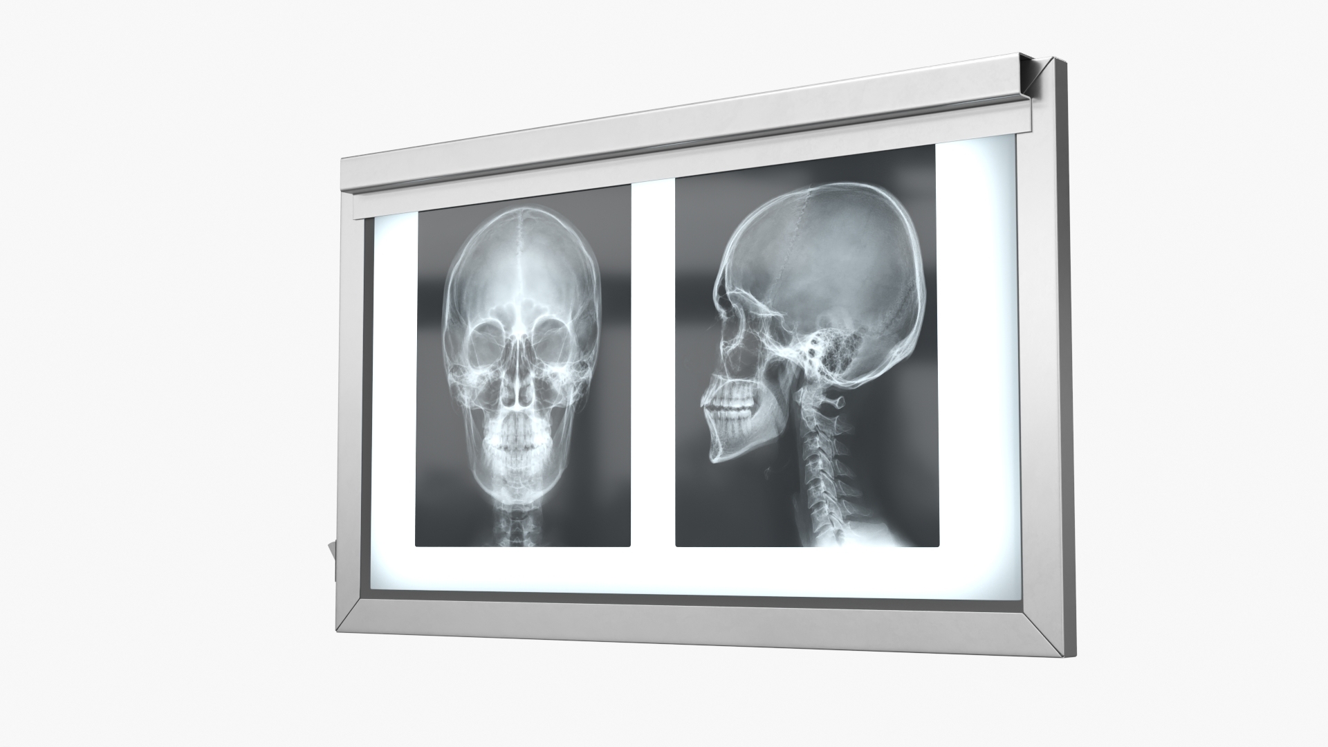 3D X Ray Lightbox with Skull Radiographs model https://p.turbosquid.com/ts-thumb/an/GCQoEV/l1/x_ray_lightbox_with_skull_radiographs_361/jpg/1786491180/1920x1080/turn_fit_q99/946ef7992dbc01835172b11e753c1cfdf725d6e2/x_ray_lightbox_with_skull_radiographs_361-1.jpg