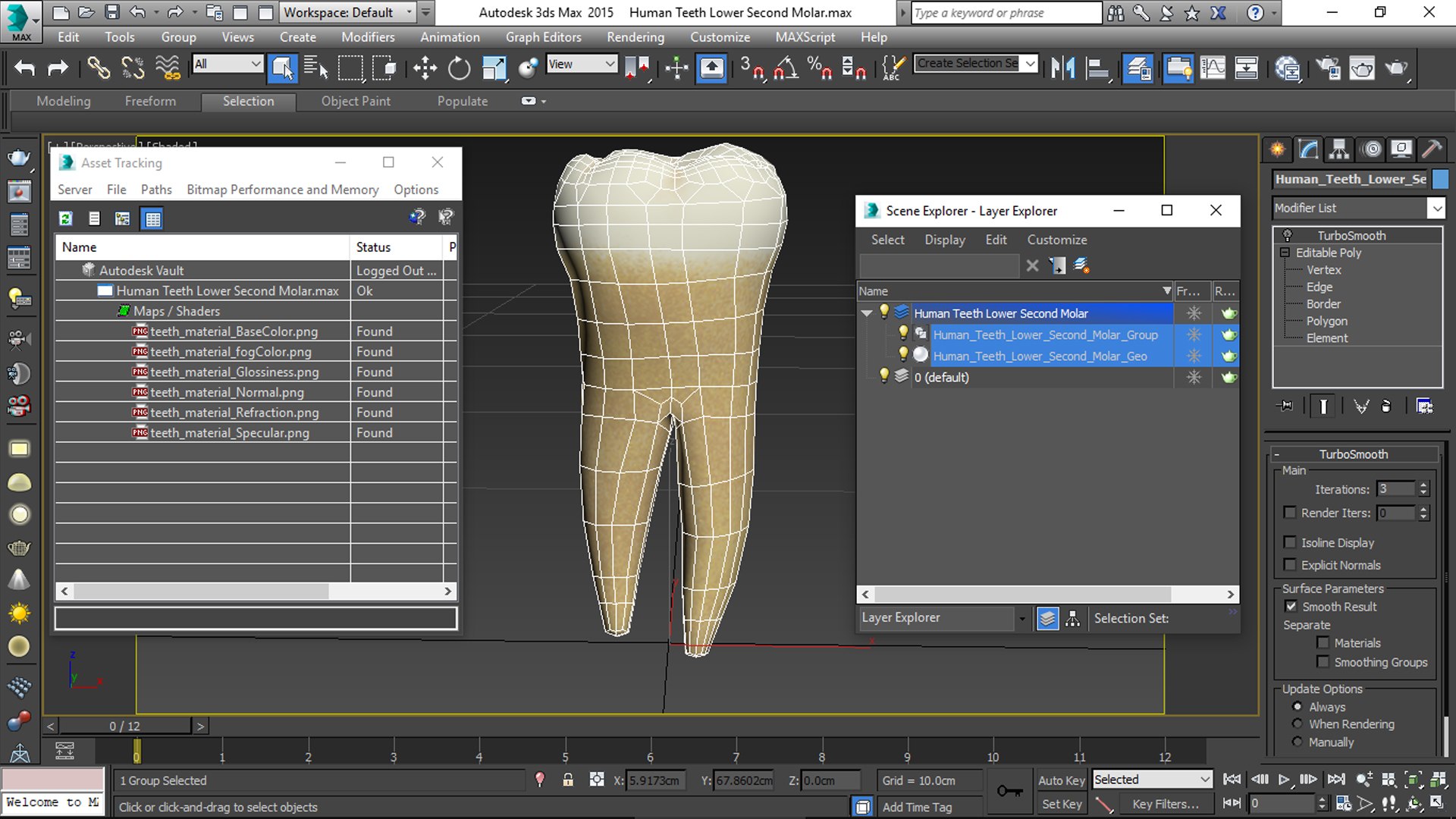 human teeth lower second 3D model https://p.turbosquid.com/ts-thumb/b5/wm5MVB/Vgndm0Xn/viewport/jpg/1591384258/1920x1080/fit_q87/520f713e1f7133e03df3f52b8eb6f1940786672a/viewport.jpg