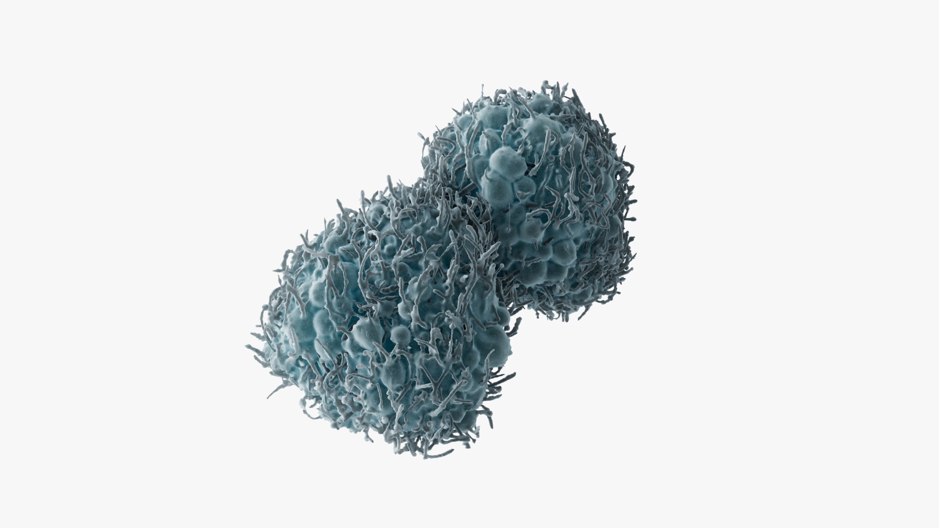 3D Cancer Cells Brain 30 Model - TurboSquid 2225366