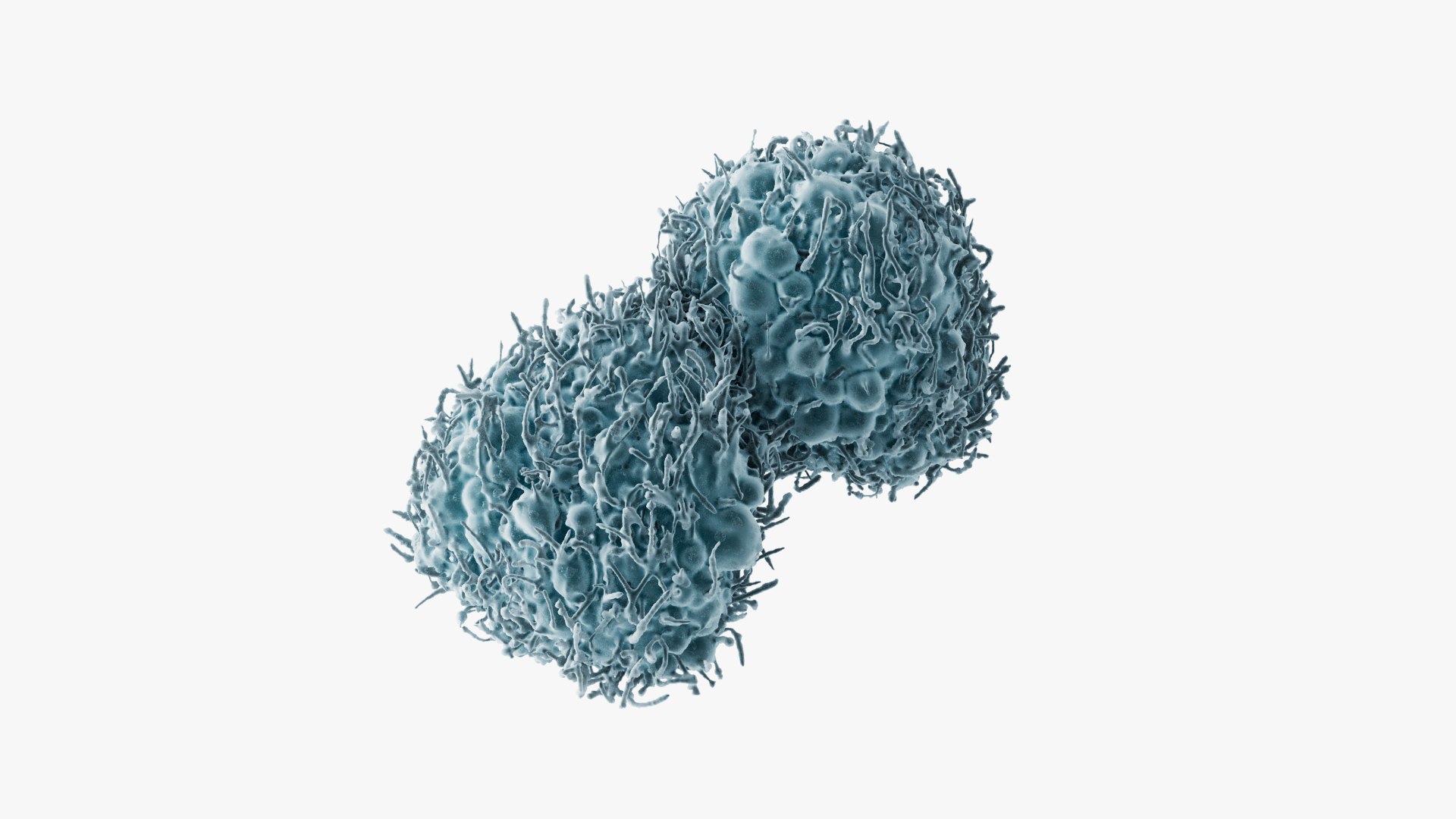 3D Cancer Cells Brain 30 Model - TurboSquid 2225366