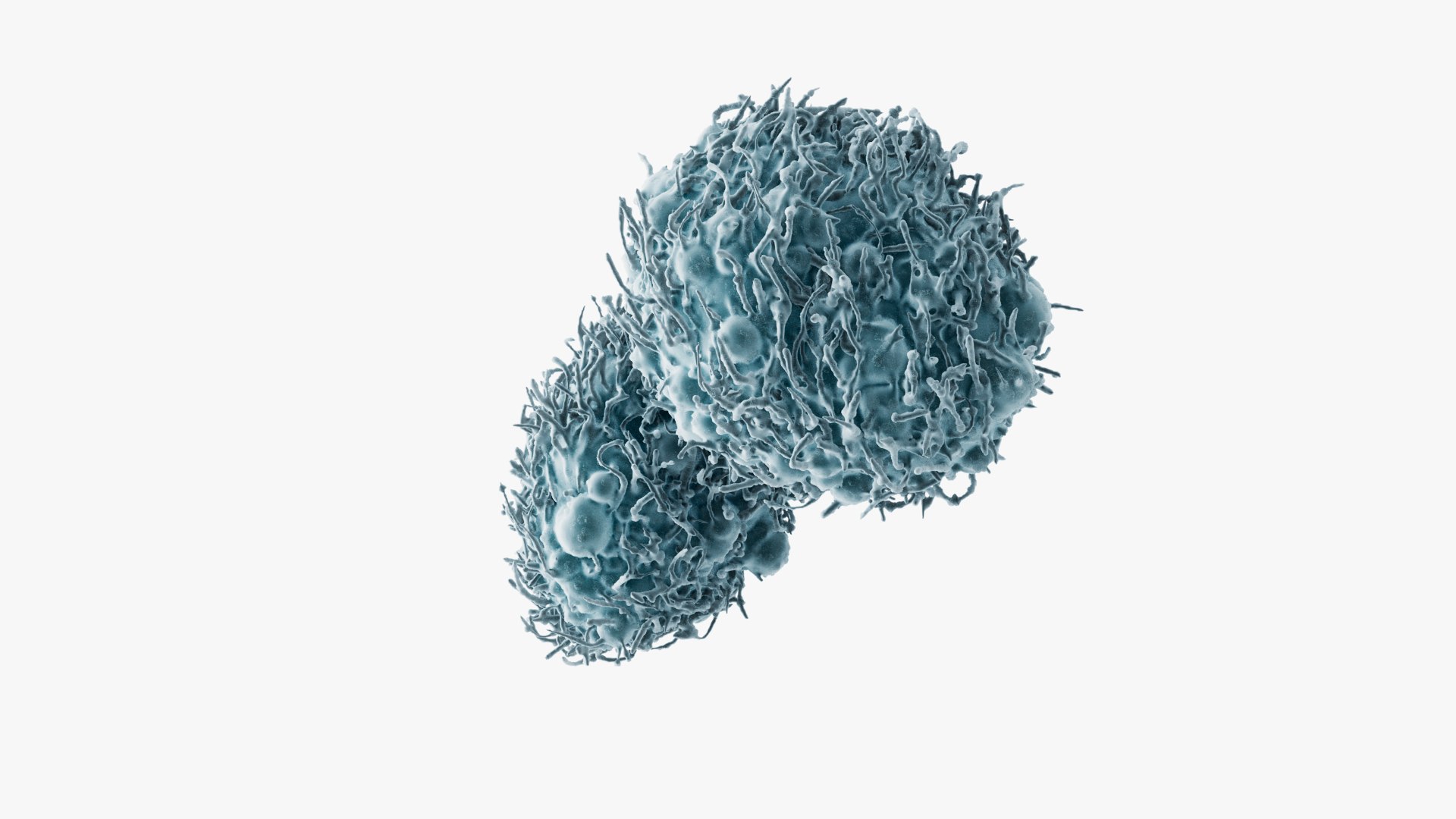 3D Cancer Cells Brain 30 Model - TurboSquid 2225366