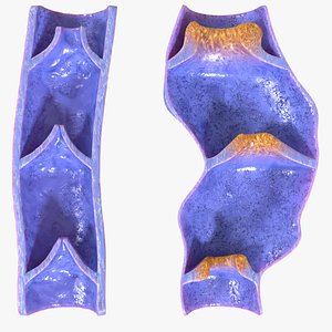 Varicose vein valve model