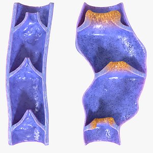 Varicose vein valve