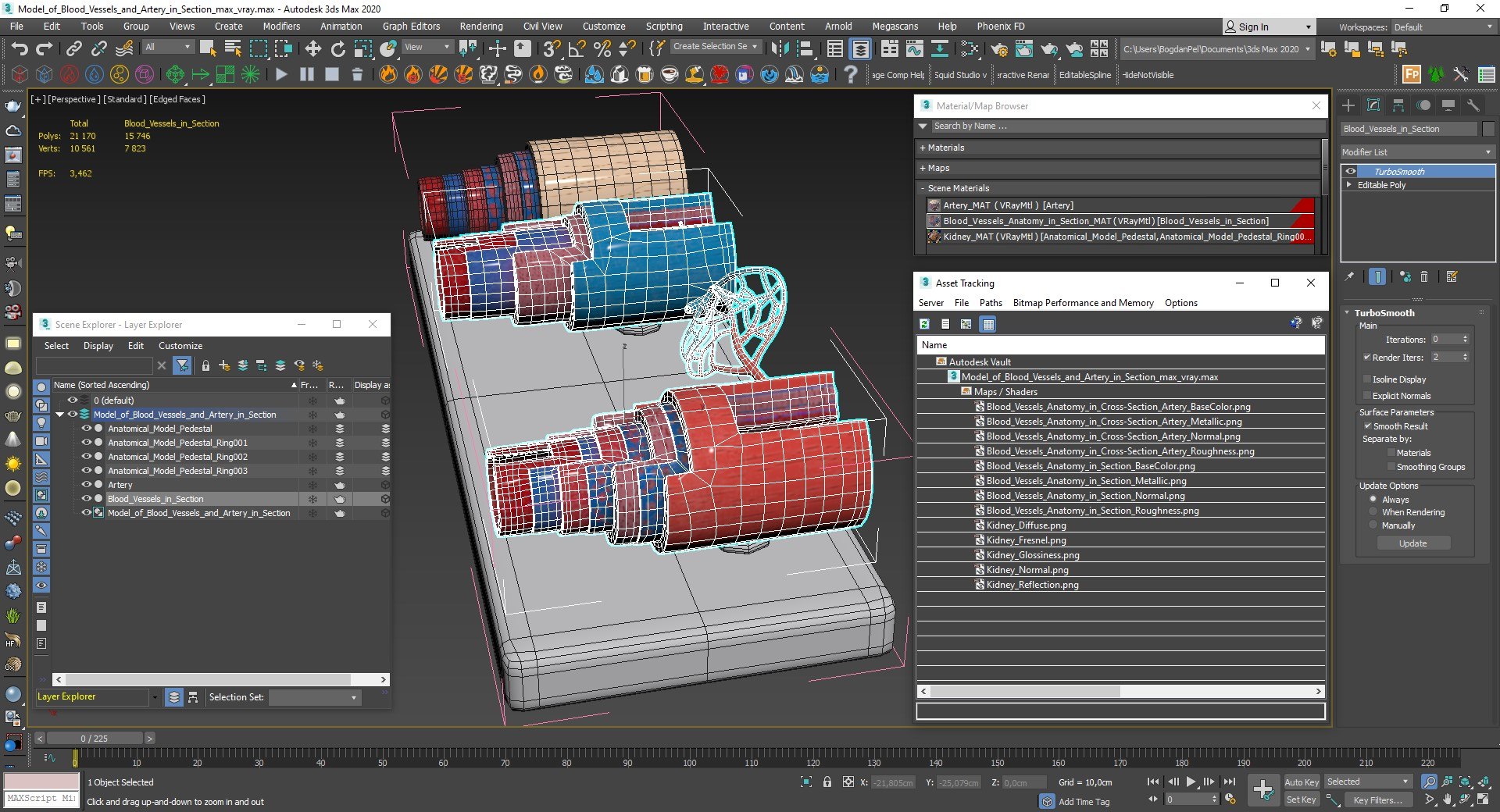 Model of Blood Vessels and Artery in Section 3D model https://p.turbosquid.com/ts-thumb/bO/nqMIDv/bz/model_of_blood_vessels_and_artery_in_section_014/jpg/1744039378/1920x1080/fit_q87/331eee0d67f217f374ed629f22433ddcae8e1746/model_of_blood_vessels_and_artery_in_section_014.jpg