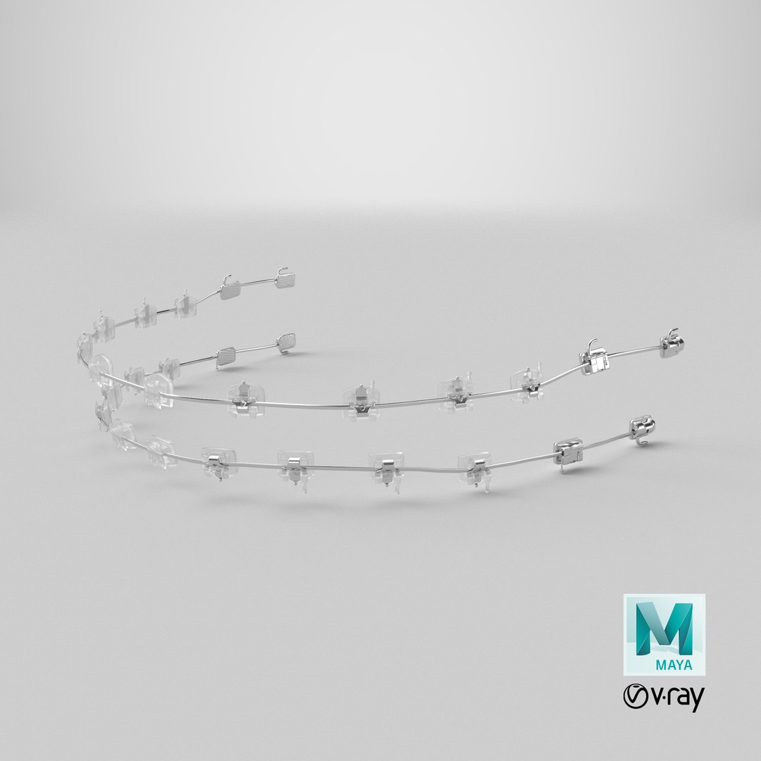 Self Ligating Transparent Dental Braces V03 3D model https://p.turbosquid.com/ts-thumb/bS/UB56D4/4n/stemcell_maya_vray_render/png/1706619583/1920x1080/fit_q87/23df46e4322a30c5a9f17d2f14ce152830f3fc2b/stemcell_maya_vray_render.jpg