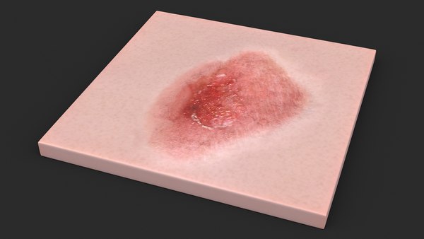 modelo 3d Piel quemada - TurboSquid 2159253