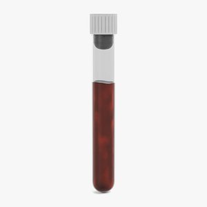 Test Tube with Blood