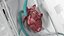 Organ Care System with Heart