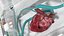 Organ Care System with Heart